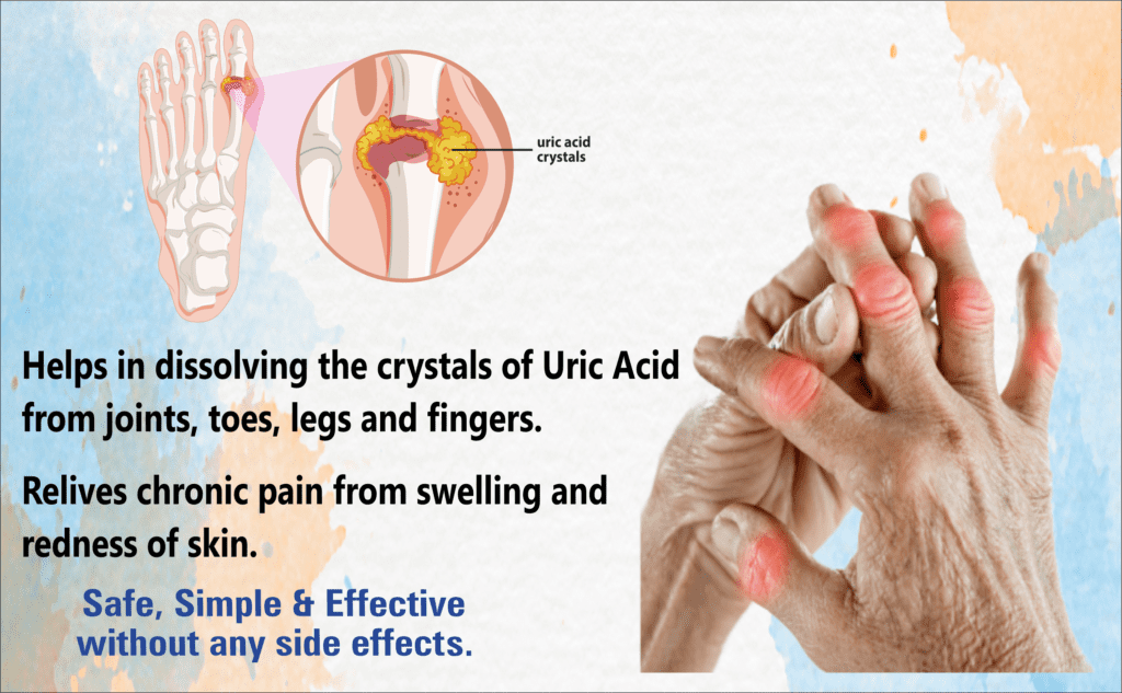 Helps in dissolving the crystals of uric acid from joints toes legs and fingers relieves chronic pain from swelling and redness of skin