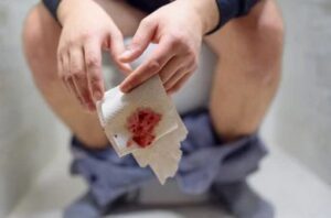 hemorrhoidal Bleeding Piles Man sitting on toilet with toilet paper